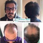before-after-10
