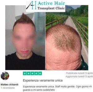 before-after-13