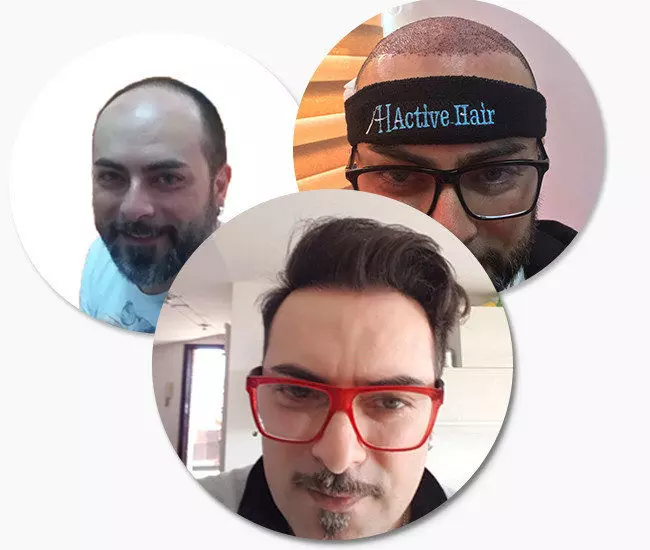 ACTI HAIR CLINIC ACTI HAIR CLINIC